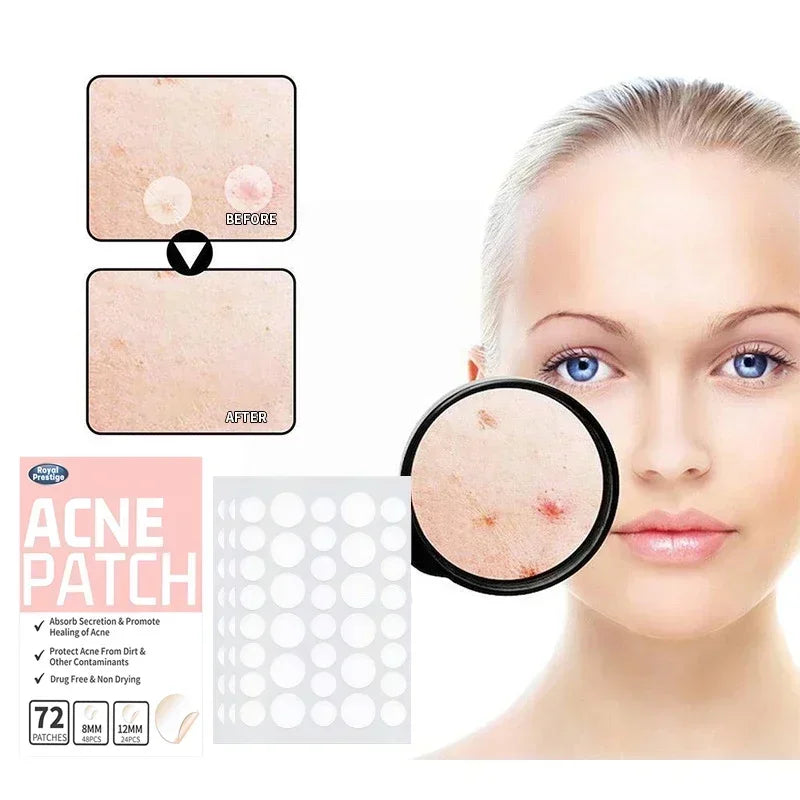 360pce face-acne-patch-invisible-skin-care-pimple-acne-patches