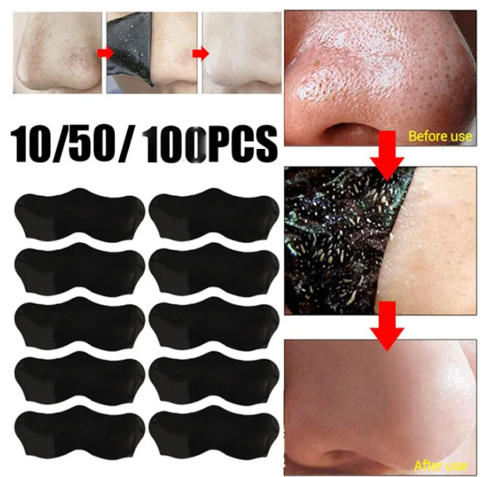 10pcs Nose Blackhead Remover