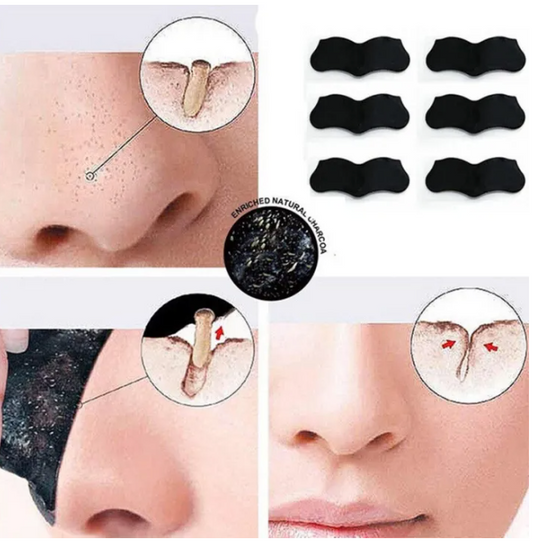 10pcs Nose Blackhead Remover