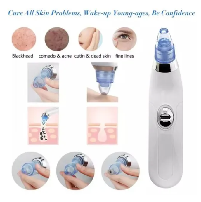 5 in 1 Electric Blackhead Acne Oil Remover Vacuum Suction Face Pore Cleaner Machine